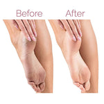 Electric Pedicure Foot File Callus Remover مزيل الكالو الكهربائي برأسين دوارين